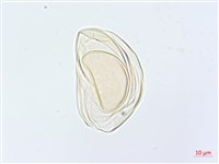 川上氏雙蓋蕨藏品圖，第2張