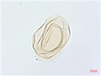 川上氏雙蓋蕨藏品圖，第3張