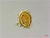 蛇脈三叉蕨藏品圖，第2張