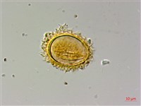 蛇脈三叉蕨藏品圖，第3張