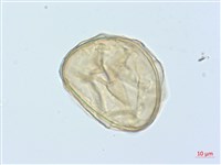 德氏雙蓋蕨藏品圖，第2張