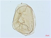 德氏雙蓋蕨藏品圖，第3張