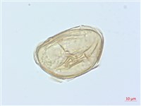德氏雙蓋蕨藏品圖，第4張