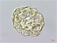 馬來陰石蕨藏品圖，第2張