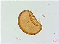 逆葉蹄蓋蕨、逆羽蹄蓋蕨藏品圖，第2張
