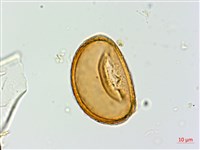 逆葉蹄蓋蕨、逆羽蹄蓋蕨藏品圖，第4張