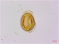 烏毛蕨藏品圖，第2張