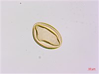 烏毛蕨藏品圖，第3張