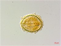 蛇脈三叉蕨藏品圖，第2張