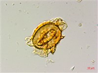 蛇脈三叉蕨藏品圖，第4張