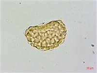 大膜蓋蕨藏品圖，第3張