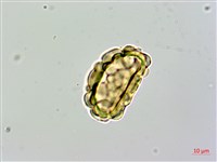 大膜蓋蕨藏品圖，第4張