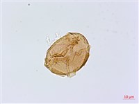 擬德氏雙蓋蕨藏品圖，第3張