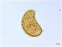 刺柄雙蓋蕨藏品圖，第2張