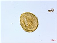 刺柄雙蓋蕨藏品圖，第4張