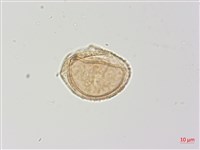 生芽蹄蓋蕨藏品圖，第2張