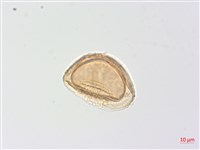 生芽蹄蓋蕨藏品圖，第3張