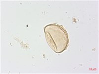 生芽蹄蓋蕨藏品圖，第2張