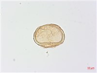 生芽蹄蓋蕨藏品圖，第3張