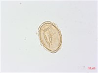 生芽蹄蓋蕨藏品圖，第4張