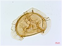 隱脈細柄雙蓋蕨藏品圖，第2張