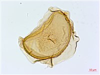 隱脈細柄雙蓋蕨藏品圖，第4張