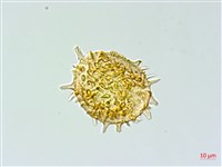 單葉雙蓋蕨藏品圖，第3張