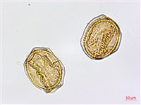 大黑柄鐵角蕨、黃鱗鐵角蕨、大羽鐵角蕨藏品圖，第4張