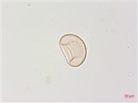 狹葉蹄蓋蕨藏品圖，第2張