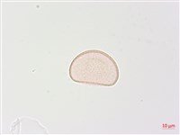 狹葉蹄蓋蕨藏品圖，第3張