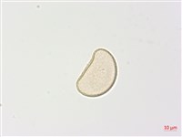 狹葉蹄蓋蕨藏品圖，第4張