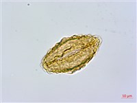 短葉蹄蓋蕨藏品圖，第3張