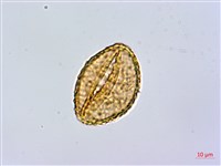 短葉蹄蓋蕨藏品圖，第4張