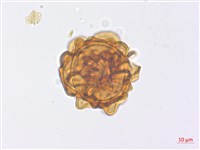 山東腫足蕨藏品圖，第4張