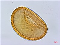 阿里山蹄蓋蕨藏品圖，第2張