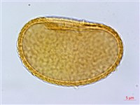 阿里山蹄蓋蕨藏品圖，第3張