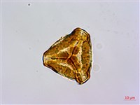 碗蕨藏品圖，第2張