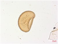 山蹄蓋蕨藏品圖，第3張