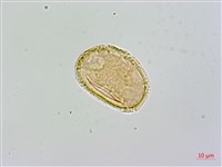 禾稈亮毛蕨藏品圖，第4張