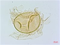 裂葉雙蓋蕨藏品圖，第2張