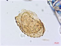 厚葉雙蓋蕨藏品圖，第4張