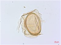 廣葉深山雙蓋蕨藏品圖，第3張