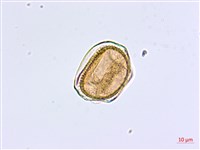 大黑柄鐵角蕨藏品圖，第2張