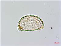 台灣小膜蓋蕨藏品圖，第2張