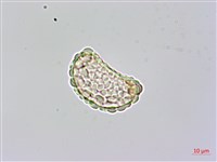 台灣小膜蓋蕨藏品圖，第3張