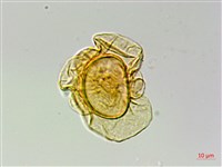 網脈突齒蕨藏品圖，第3張