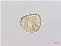 邊緣鱗蓋蕨藏品圖，第4張