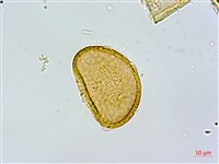 坡生蹄蓋蕨藏品圖，第2張