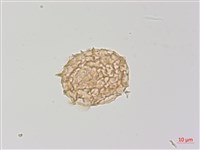 毛葉軸脈蕨藏品圖，第2張