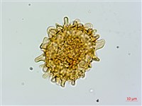 毛軸假蹄蓋蕨藏品圖，第4張